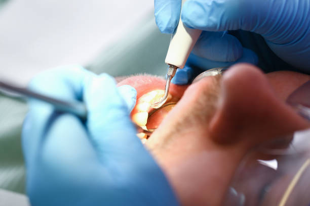 Best Emergency Denture Repair in Appleton, MN