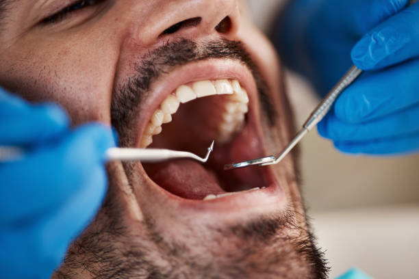Best Pediatric Emergency Dentist in Appleton, MN