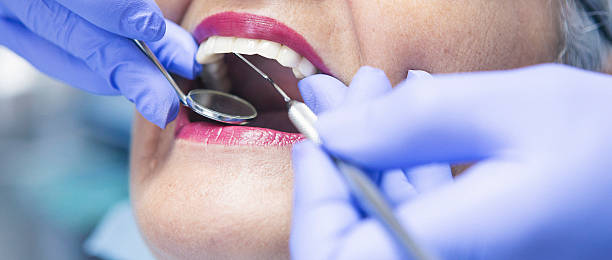 Best Emergency Gum Treatment in Appleton, MN